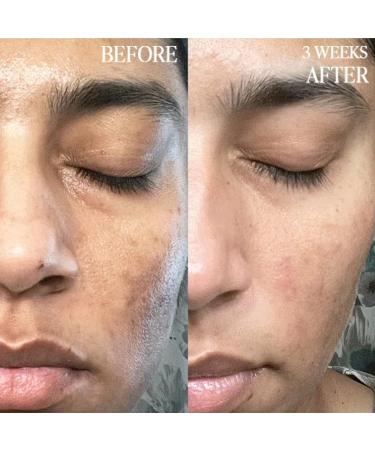 BYROE Kiwi Gel Cleanser | AHA BHA Face Wash for Breakouts | Balance Redness, Blackheads | Vegan | 65ml - Buy Online on GoSupps.com