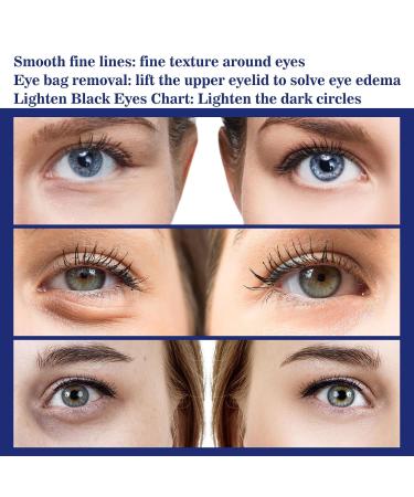 Anti-Wrinkle Eye Cream & Serum | Instant Firming Treatment for Dark Circles & Puffiness (5PCs) - Buy Online on GoSupps.com