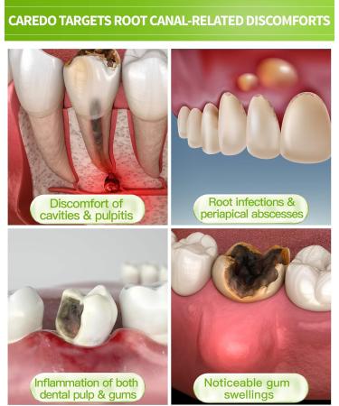 Toothpaste for Gum Repair & Root Canal Relief | Remineralizing Hydroxyapatite Mint Flavor - 3.52 OZ - Buy Online on GoSupps.com