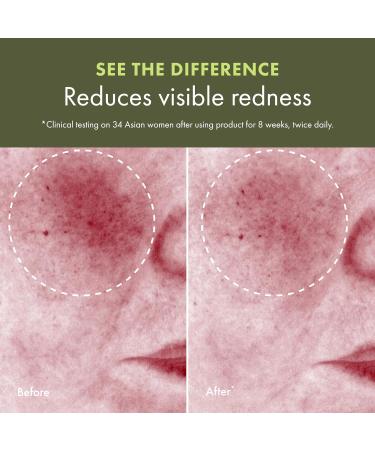 Origins Mega-Mushroom Soothing Treatment Lotion | Great for Sensitive Skin | With Reishi Mushroom 6.7 Fl Oz (Pack of 2) - Full Size - Buy Online on GoSupps.com