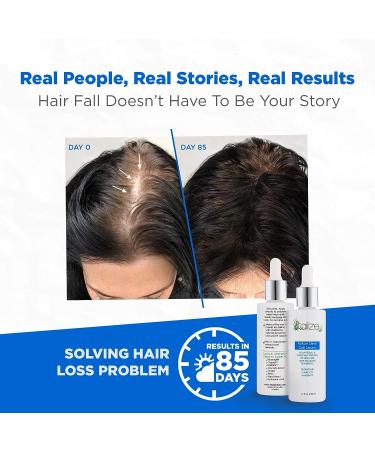 Follicle Stem Cell Serum with Redensyl, Capixyl, HairSpa - 1.7 fl oz - Hair Growth & Scalp Treatment - Buy Online on GoSupps.com