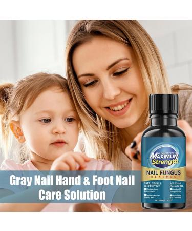 Solution de soin des ongles gris pour les mains et les pieds r paration des ongles solution de renouvellement des ongles aide r duire la d formation des ongles douce et nourrissante 30 ml pour - Buy Online on GoSupps.com