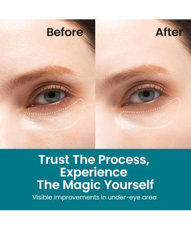 Moisturizing Under Eye Patches for Dark Circles - Korean Snail Mucin Eye Treatment & Puffy Eye Solution - Buy Online on GoSupps.com