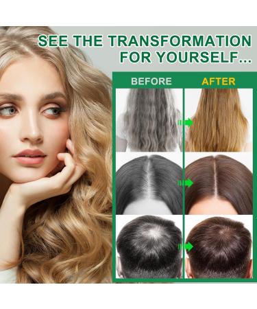 Batana Oil for Hair Growth.100% Raw Batana Oil-4.2 OZ Organic Batana Oil from Honduras-Prevent Hair Loss Promote Hair Thickness- Hair Care for Women & Men - Buy Online on GoSupps.com