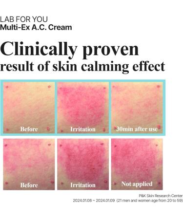  LAB FOR YOU Multi-Ex A.C. Cream | Spot treatment | Korean cosmetics | blemish relief | teatree leaf oil | 20ml/0.7 fl.oz - Buy Online on GoSupps.com