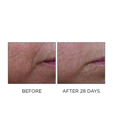 Cold Plasma Plus+ Advanced Serum Concentrate - 1oz | Powerful Skincare Solution - Buy Online on GoSupps.com