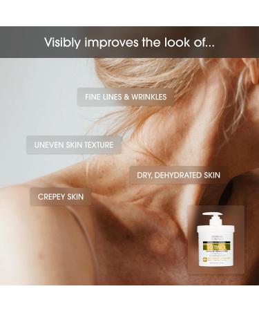Advanced Clinicals Retinol Body Lotion & Face Moisturizer |  Anti Aging Skin Care With Retinol  - Targets Wrinkles&Stretch Marks - 16 Ounce - 454g  - Buy Online on GoSupps.com