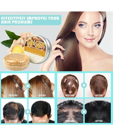 Ginger Hair Regrowth Shampoo Bar | Anti Hair Loss Soap for Hair Growth | Natural Organic Darkening Shampoo Bar | Promotes Hair Growth | 3pcs - 1.92 Ounce (Pack of 3) - Buy Online on GoSupps.com