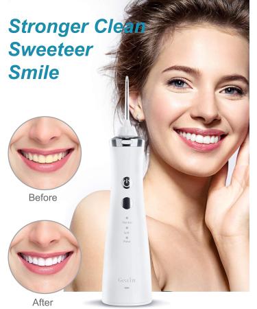 Gealm Cordless Water Flosser - 3 Modes, 4 Jet Tips, IPX7 Waterproof, USB Rechargeable Teeth Cleaner for Travel & Home - White - Buy Online on GoSupps.com