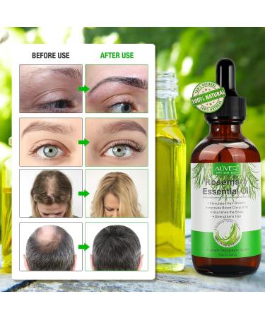 Organic Rosemary Hair Growth Oil 2.02 Fl Oz + Scalp Massager | Pure Essential Oil for Eyelashes, Eyebrows, Skin, Body Massage | Nourishes Scalp, Improve Blood Circulation - Buy Online on GoSupps.com