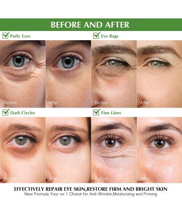 Enaskin Naturals Under Eye Patches - Dark Circle & Puffiness Masks with Green Tea Collagen Niacinamide & Caffeine - Reduces Wrinkles & Fine Lines - 4oz - Buy Online on GoSupps.com