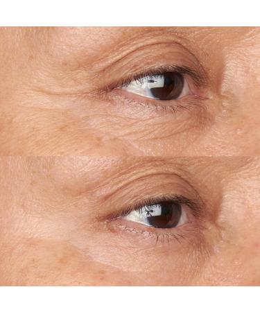 Buy Hypoallergenic Clean Correction Firming & Brightening Eye Cream - 0.5 fl. oz. | International Shipping Available - Buy Online on GoSupps.com