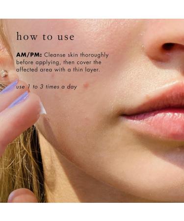 Bioelements Breakout Control - 5% Benzoyl Peroxide Acne Spot Treatment for Acne-Prone Skin - Vegan & Gluten Free - 1 fl oz - Buy Online on GoSupps.com