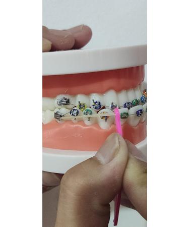 15PCS RZJZGZ Dental Elastic Rubber Bands Placers for Braces - Disposable Plastic Orthodontic Elastic Placers - Buy Online on GoSupps.com