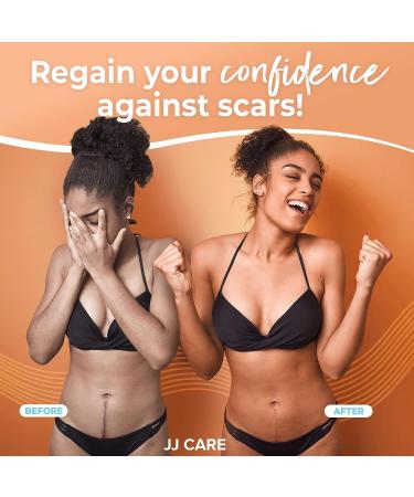 JJ CARE 1.6 x 120 Soft Silicone Scar Tape - Flexible, Washable & Reusable Medical Grade Strips for Surgical Scars - Latex-Free Silicone Tape - Buy Online on GoSupps.com