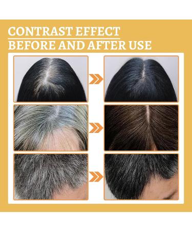 VisTapex DARKA Anti-Greying Hair Serum - Ganoderma Nutrient for Healthier, Thicker Hair (3Pcs) - Buy Online on GoSupps.com