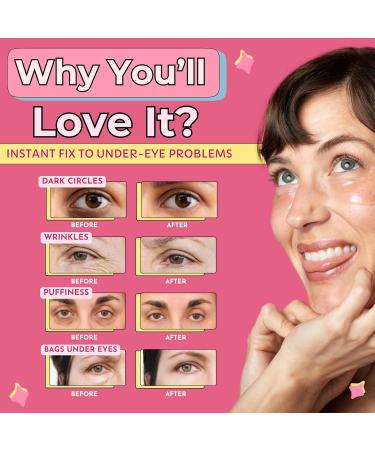 RevitalEyez Brightening Hydrogel Under Eye Patch - Niacinamide Collagen & Rose Petals for Puffy Eyes & Dark Circles (10 Pairs) - Best International Shipping - Buy Online on GoSupps.com