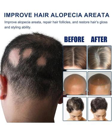 Stimulateur de des cheveux cultivateur de tresse biologique p te stimulante de densit moyen de coiffage durable beaut masculine f minine r cipient portable id al pour un seul produit - Buy Online on GoSupps.com