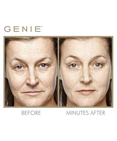 Genie Instant Line Smoother - Anti-Aging Serum (19 ml) | Instant Wrinkle Remover for Face | Reduce Fine Lines, Bags, and Wrinkles | 0.64 Fl Oz - Buy Online on GoSupps.com