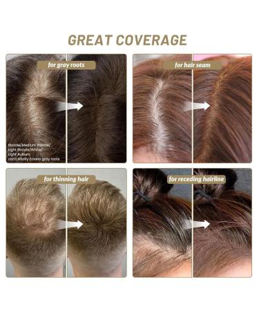 Hairline Shadow Powder | Magic Root Cover Up & Touch Up Powder with Mirror - Instant Concealment for Hair Loss (#06 Dark Brown) - Shop Internationally - Buy Online on GoSupps.com