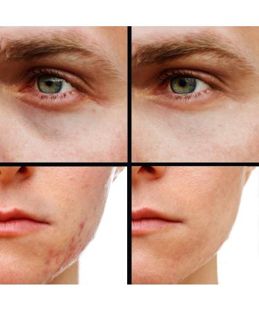 KODE Mens Concealer Shade 2 - Dark Circle Under Eye Cream Corrector for Pimples, Scars, Rashes | Multi-Use Formula - Buy Online on GoSupps.com
