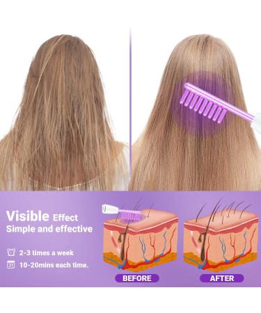 UUPAS Portable High Frequency Facial Machine - Handheld Facial Wand - Buy Online on GoSupps.com