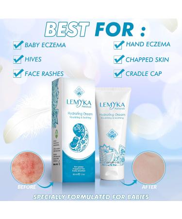 Organic Baby Eczema Cream - Soothing Relief for Dry Itchy Skin Psoriasis Dermatitis & Hives | Non-Greasy Balm for Lasting Hydration - Buy Online on GoSupps.com