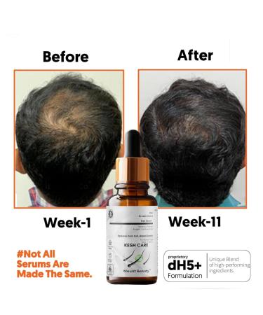 Hair Active Growth Serum for Men & Women | Vegan Formula for Thinning Hair & Hair Loss - 50ml - Buy Online on GoSupps.com