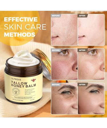 Ultrove Beef Tallow and Honey Balm for Skin Natural Face + Body Moisturizer with Organic Grass-Fed Beef Tallow & Raw Wild Honey for Dry & Sensitive Skin 4.23oz - Buy Online on GoSupps.com