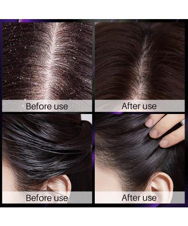 Onion Shampoo Strengthens Hair & Revitalizes Hair for Thinning Hair & Hair Loss Soft & Shiny & Reduces Frizz Moisturizes & Restores for All Hair Types - Buy Online on GoSupps.com