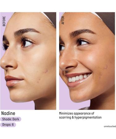 Isle of Paradise Self Tanning Face Drops Dark (30 ml) - Natural & Vegan Self Tanning Drops for Skin Care - Dark Shade (Pack of 1) - Buy Online on GoSupps.com