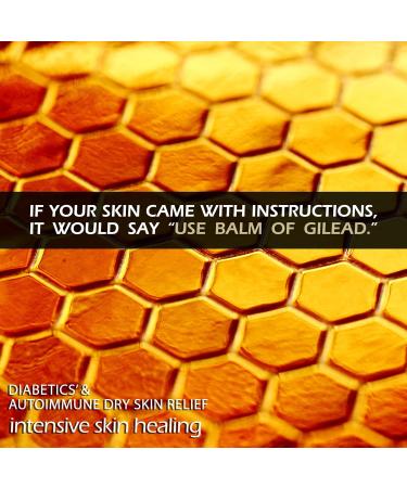 BALM OF GILEAD Neuropathy Frankincense & Sweet Myrrh Therapeutic Rubbing Oil - Instant Diabetic's & Autoimmune Dry Skin Relief & Repair 2 fl oz - Buy Online on GoSupps.com