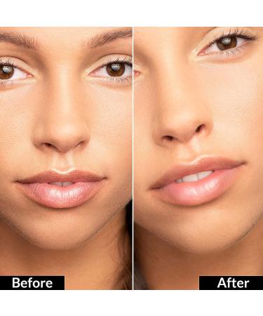 True + Luscious Flowerdose 2-in-1 Lip Plumping & Eye Serum 0.5 oz - Hydrating Anti-Aging Formula for Dry Lips & Dark Circles - Buy Online on GoSupps.com