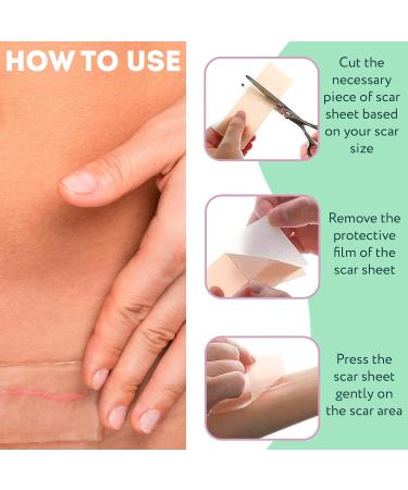 Reusable Silicone Scar Sheets for Surgical Scars | Pack of 4 | Soft Silicone Scar Removal Tape for C-Section Keloid & Burn Scars - Travel Size 1.6 x 3 Inches - Buy Online on GoSupps.com