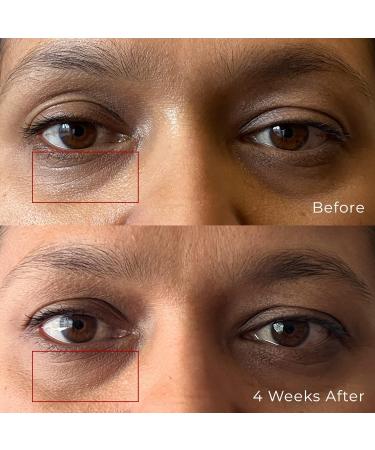 Peptide Eye Gel | Hydrating Firming & Brightening | Reduce Fine Lines | Fragrance Free (0.4 Oz - Buy Online on GoSupps.com