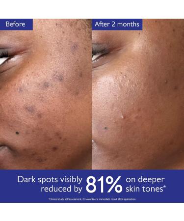 Caudalie Vinoperfect Brightening Dark Spot Serum Vitamin C Alternative - 62x More Effective than Vitamin C with Viniferine for a Visibly Brighter Even Complexion 30 mL (Pack of 1) - Buy Online on GoSupps.com