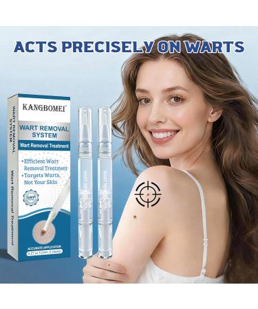 Anti-Verrues Stylo D' limination des Verrues Kit Convient Tous les Types de Peau Anti-Verrues Stylo 2 pi ce - Buy Online on GoSupps.com