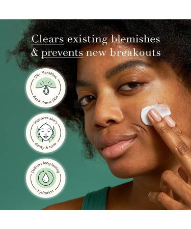 Rael Miracle Clear Barrier Cream with Succinic Acid & Vitamin B - Daily Moisturizer for Oily Skin - Paraben-Free & Vegan - 1.8 oz - Buy Online on GoSupps.com
