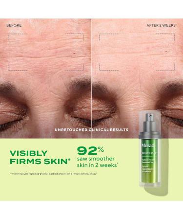 Murad Rejuvenate + Replenish w/ Healthy Skin - 3-Piece Full Sized Set ($213 Value) - Regimen for Total Skin Health - Ess-C Cleanser 6.75Fl Oz Retinol Serum 1.0Fl Oz Hydro Dynamic Moisture 1.7Fl Oz - Buy Online on GoSupps.com