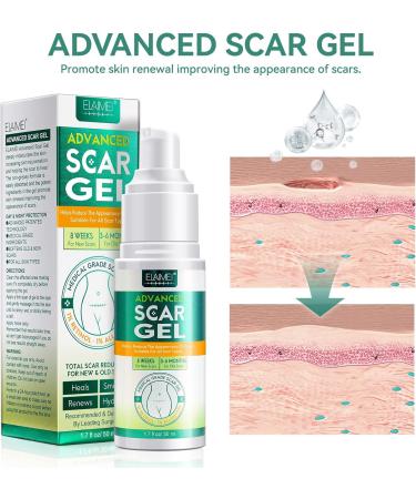 Scar Gel Cream - Advanced Treatment for Old & New Scars | Remove Scars from Face & Body - Surgical, C Section, Burn, Keloids | 50g - Buy Online on GoSupps.com