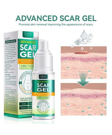 Scar Removal Gel - 50ML | Silicone Cream for C-Section, Stretch Marks, Acne & Surgery Scars - Buy Online on GoSupps.com