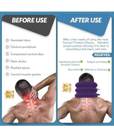 Jaximy Purple Neck Stretcher & Cervical Traction Device for Neck Pain Relief - Adjustable Inflatable Neck Brace & Cervical Pillow for Home Use - Buy Online on GoSupps.com
