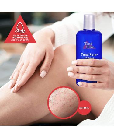 Tend Skin Refillable Ingrown Hair Rollon 2.5 oz | For Women & Men - Buy Online on GoSupps.com