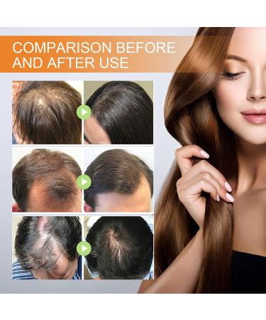 Pumpkin Seed Oil for Hair - Pumpkin Seed Oil - 100% Pure Pumpkin Seed Oil Cold Pressed for Skin Face Hair Care Eyebrow and Eyelash - Repairing Dry Damaged Hair - 60ml (2) - Buy Online on GoSupps.com