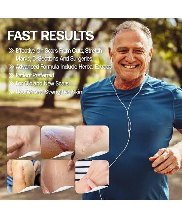 Maximum Strength Scar Cream & Stretch Mark Treatment - C-Section & Body Scars | Fast Results - Buy Online on GoSupps.com