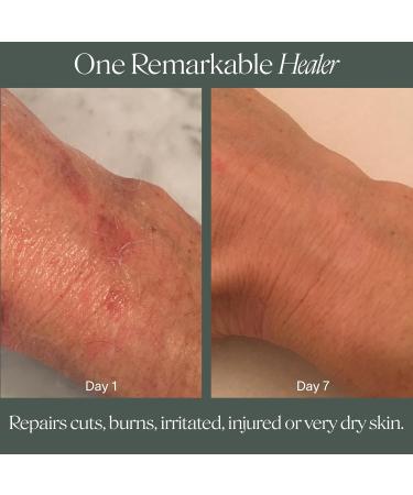 Doctor Rogers Restore Healing Balm. Multi-Purpose Healing Ointment & Moisturizing Eczema Relief Gel Protects & Soothes Injured Sensitive & Dry Skin 5 gram Tube (Pack of 3) 0.17 Ounce (Pack of 3) - Buy Online on GoSupps.com