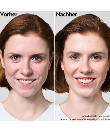 M. Asam Aqua Intense Supreme Hyaluron Day Cream (50ml) - Vegan Anti-Aging Moisturizer SPF 25 Perfume-Free Intensive Hydration for Smoother Skin - Buy Online on GoSupps.com