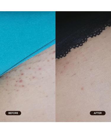 Bushbalm Exfoliating Ingrown Hair Pads - Enhanced with BHA & AHA for Underarm + Bikini Area - Daily Use to Soothe Ingrown Hairs & Razor Bumps - TXA for Dark Spots - Radiant Reset 30 Large Pads - Buy Online on GoSupps.com