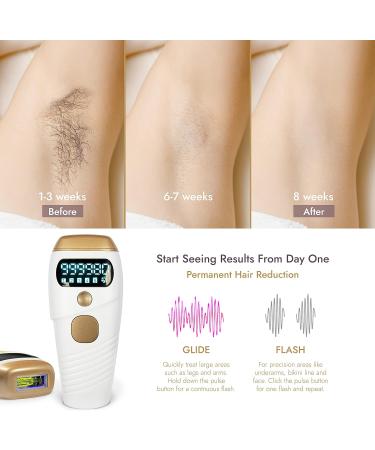 IPL Hair Removal Laser by UK Company - Permanent Hair Remover for Sensitive Skin - Buy Online on GoSupps.com