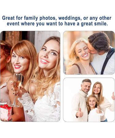 Buy Batlam False Teeth - Comfortable Upper Jaw Veneers for Men & Women | Bright White Dental Replacement for a Confident Smile - Buy Online on GoSupps.com